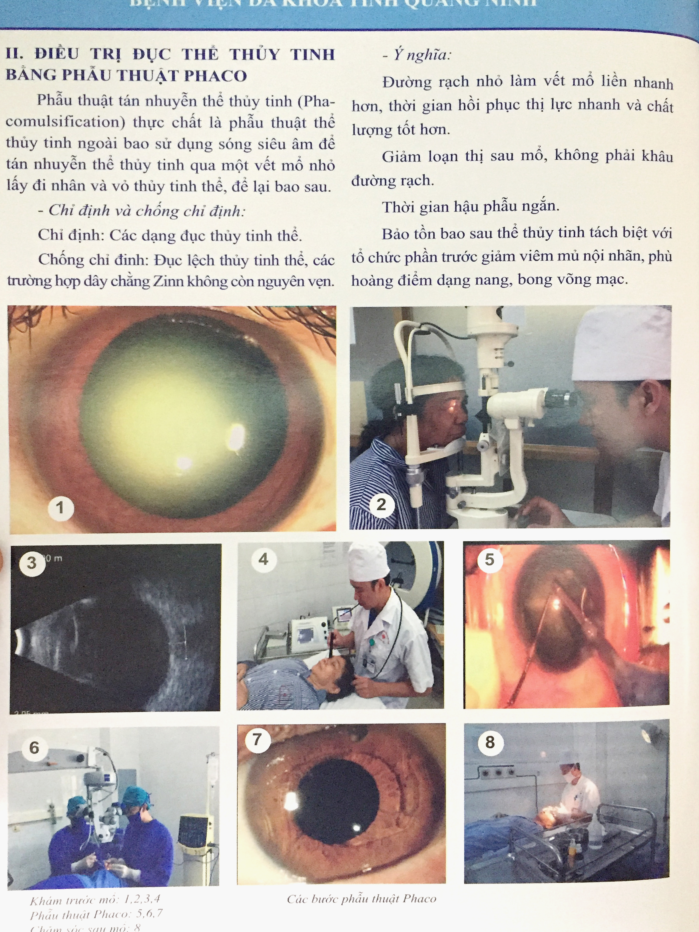 Phẫu thuật chuyên khoa mắt 2