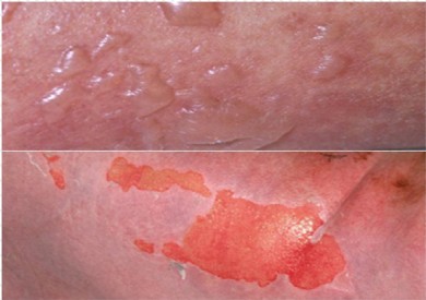 Nguy hiểm tính mạng do uống thuốc nam không rõ nguồn gốc