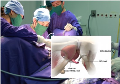 Bệnh viện Đa khoa tỉnh triển khai phương pháp TOT: Xoá mặc cảm són tiểu ở phụ nữ