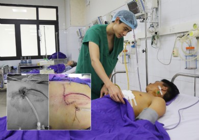 Kích hoạt “báo động đỏ” cứu sống bệnh nhân tai nạn giao thông chấn thương lộ tim nguy kịch