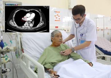 Cứu sống bệnh nhân tắc động mạch phổi nguy kịch bằng thuốc tiêu sợi huyết