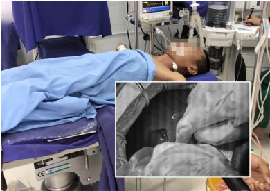 Phối hợp liên viện cứu sống bệnh nhân ở đảo Cô Tô bị vết thương thấu bụng nguy kịch