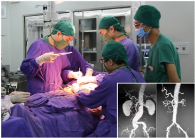 Nhập viện điều trị sỏi thận, bệnh nhân bất ngờ phát hiện phình động mạch chủ bụng