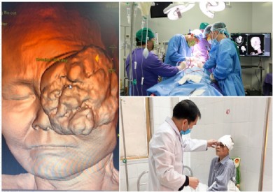Hành trình mang lại cuộc sống mới cho cựu thanh niên xung phong bị u mắt ác tính