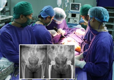 Cụ bà 80 tuổi thay khớp háng đồng thời hai bên, phục hồi vận động sau 2 ngày