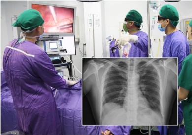 Cẩn trọng với bệnh lý nhão cơ hoành