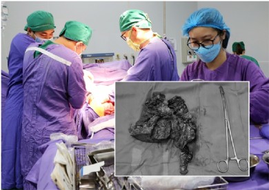 Hành trình cứu sống bệnh nhân sốc đa chấn thương, vỡ gan phức tạp