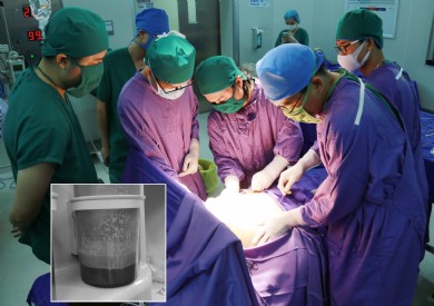 Bệnh viện Đa khoa tỉnh Quảng Ninh triển khai phẫu thuật thẩm mỹ tạo hình thành bụng