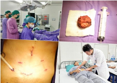 Bệnh viện Đa khoa tỉnh Quảng Ninh tiên phong triển khai phẫu thuật nội soi cắt toàn bộ tuyến tiền liệt
