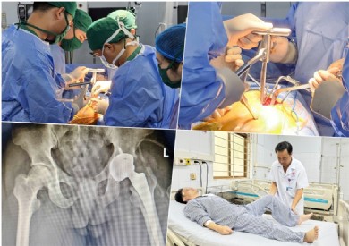 SuperPath - Đột phá mới với kỹ thuật thay khớp háng nhân tạo ít xâm lấn
