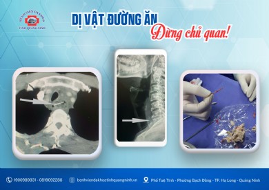 Dị vật đường ăn: Đừng chủ quan!