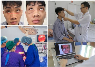 Bệnh viện Đa khoa tỉnh Quảng Ninh tiên phong ứng dụng công nghệ cao trong phẫu thuật tạo hình thành ổ mắt