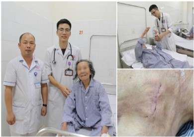 Đặt máy tạo nhịp vĩnh viễn cứu cụ bà 95 tuổi bị đột quỵ não kèm rối loạn nhịp chậm phức tạp