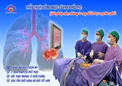 Phẫu thuật lồng ngực có video hỗ trợ (VATS): Giải pháp nhẹ nhàng trong điều trị ung thư phổi