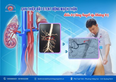 Can thiệp đặt stent động mạch thận điều trị tăng huyết áp kháng trị